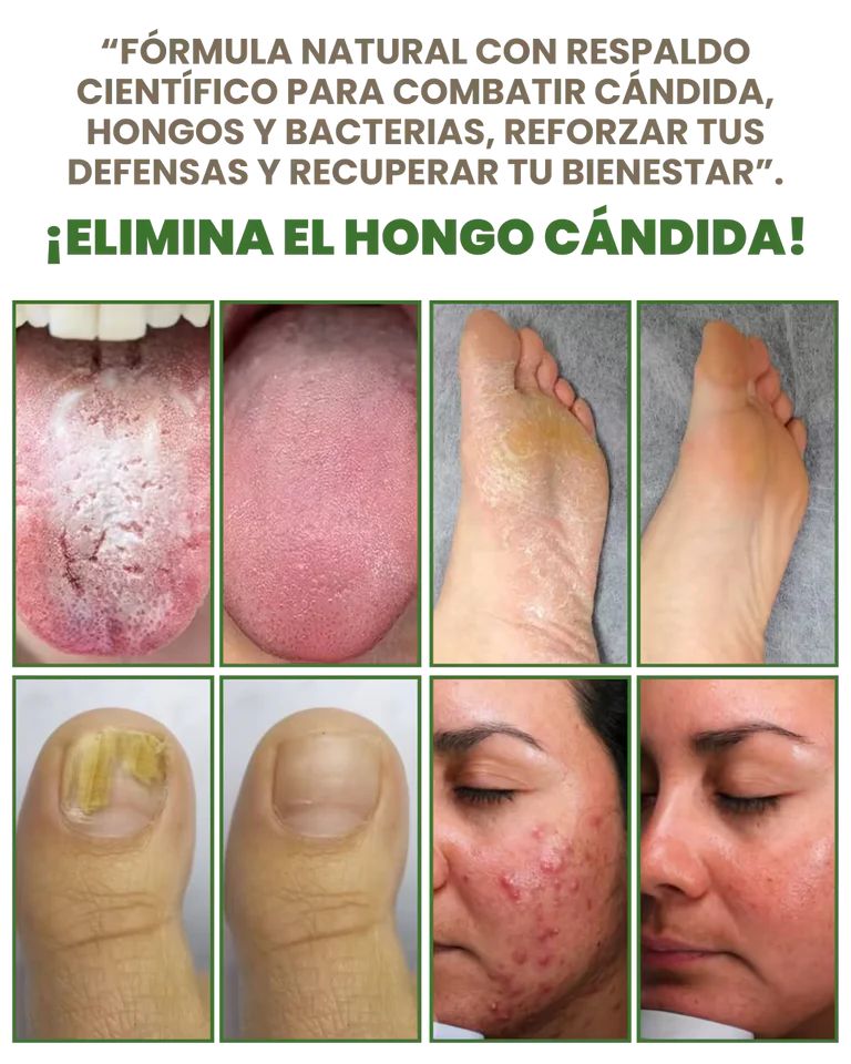 ✨CAPSULAS VITALES DE OREGANO  ✨ TU CUERPO MERECE QUE LO CUIDES ✨